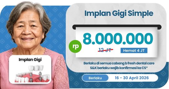 Implan Gigi Simple